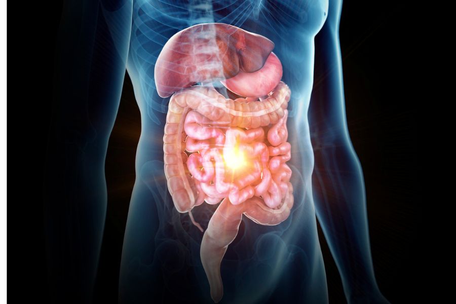 Alterações na evacuação pós cirurgia e radioterapia